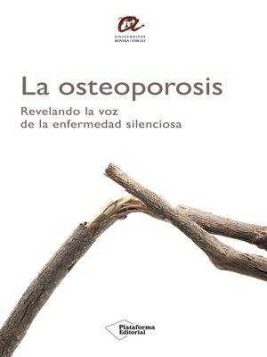 La osteoporosis - ebook